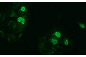 Anti-ZIM2 mouse monoclonal antibody (ABIN2453801) immunofluorescent staining of COS7 cells transiently transfected by pCMV6-ENTRY ZIM2 (RC211188). (ZIM2 antibody  (AA 1-150, AA 428-527))