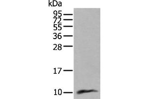 Western blot analysis of Human lung tissue lysate using CCL18 Polyclonal Antibody at dilution of 1:400 (CCL18 antibody)