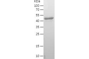WW and C2 Domain Containing 2 (WWC2) (AA 1-242) protein (His-IF2DI Tag)
