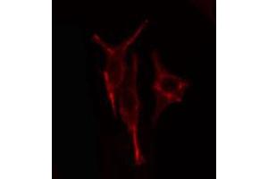 ABIN6274857 staining HuvEc cells by IF/ICC. (Apolipoprotein L 2 antibody  (C-Term))