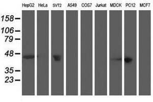 Image no. 5 for anti-Aminoacylase 1 (ACY1) antibody (ABIN1496453) (Aminoacylase 1 antibody)