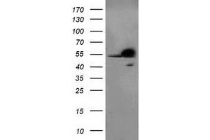 Western Blotting (WB) image for anti-Retinoblastoma Binding Protein 7 (RBBP7) antibody (ABIN1500626) (RBBP7 antibody)