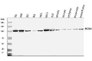 Western blot analysis of MCM6 using anti-MCM6 antibody (ABIN7600035).