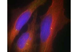 Image no. 1 for anti-Synaptotagmin I (SYT1) (Ser309) antibody (ABIN401634) (SYT1 antibody  (Ser309))