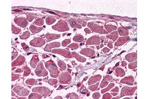 MBNL1 antibody  (AA 1-383)