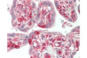 Human Placenta: Formalin-Fixed, Paraffin-Embedded (FFPE). (LRRFIP1 antibody  (HRP))