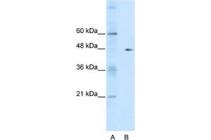 Western Blotting (WB) image for anti-GDP Dissociation Inhibitor 2 (GDI2) antibody (ABIN2463746) (GDI2 antibody)
