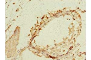 Immunohistochemistry of paraffin-embedded human testis tissue using ABIN7169096 at dilution of 1:100 (NEK11 antibody  (AA 245-482))