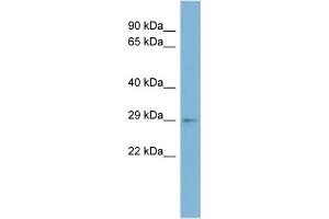 WB Suggested Anti-ARV1 Antibody Titration:  0. (ARV1 antibody  (Middle Region))