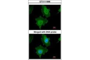 Image no. 2 for anti-Caspase 14, Apoptosis-Related Cysteine Peptidase (CASP14) (AA 171-230) antibody (ABIN467554) (CASP14 antibody  (AA 171-230))