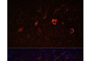 Immunofluorescence (IF) image for anti-Kallmann Syndrome 1 Sequence (KAL1) antibody (ABIN7259102)
