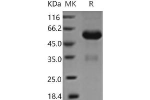 Western Blotting (WB) image for Layilin (LAYN) protein (Fc Tag) (ABIN7321085) (Layilin Protein (LAYN) (Fc Tag))