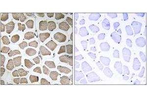 Immunohistochemistry analysis of paraffin-embedded human skeletal muscle tissue, using MOT12 Antibody. (MOT12 antibody  (AA 115-164))