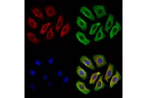 SEC61A Antibody staining Hela cells by IF/ICC.