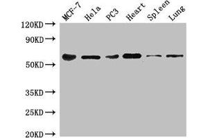 Western Blot Positive WB detected in: MCF-7 whole cell lysate, Hela whole cell lysate, PC-3 whole cell lysate, Mouse heart tissue, Mouse spleen tissue, Mouse lung tissue All lanes: TROVE2 antibody at 3 μg/mL Secondary Goat polyclonal to rabbit IgG at 1/50000 dilution Predicted band size: 61, 24, 59, 60 kDa Observed band size: 61 kDa (TROVE2 antibody  (AA 3-535))