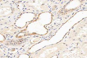 Immunohistochemistry analysis of paraffin-embedded human kidney using,MTND1 (ABIN7074658) at dilution of 1: 1000 (MT-ND1 antibody)