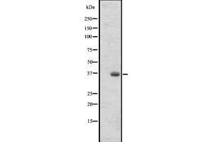 Western blot analysis of OR2T27 expression in 293 cell line lysates ,The lane on the left is treated with the antigen-specific peptide. (OR2T27 antibody  (Internal Region))