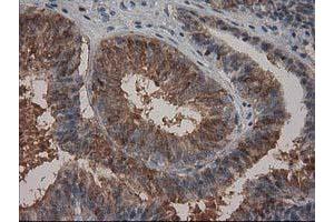 Immunohistochemistry (IHC) image for anti-Hydroxyprostaglandin Dehydrogenase 15-(NAD) (HPGD) antibody (ABIN1496362) (HPGD antibody)