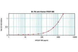 Image no. 1 for anti-PDGF-BB Homodimer antibody (Biotin) (ABIN465515) (PDGF-BB Homodimer antibody (Biotin))