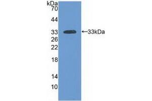 Detection of Recombinant LAMa3, Human using Polyclonal Antibody to Laminin Alpha 3 (LAMa3) (LAMA3 antibody  (AA 47-296))