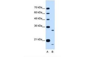 Image no. 1 for anti-Cell Cycle Progression 1 (CCPG1) (AA 301-350) antibody (ABIN6738251) (CCPG1 antibody  (AA 301-350))