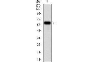 Western blot analysis using TIE1 mAb against human TIE1 (AA: 385-607) recombinant protein. (TIE1 antibody  (AA 385-607))