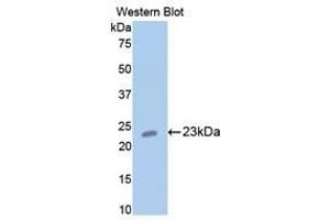 Western Blotting (WB) image for anti-Cartilage Oligomeric Matrix Protein (COMP) (AA 235-423) antibody (ABIN1858467) (COMP antibody  (AA 235-423))