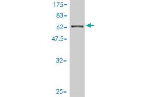 Western Blot detection against Immunogen (67. (CTNNA3 antibody  (AA 1-376))