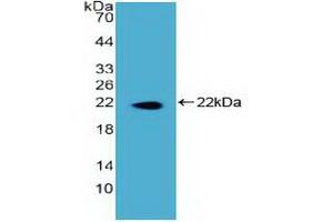 Western blot analysis of recombinant Human DKC.