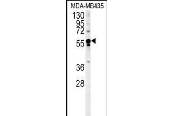 ARHGEF3 antibody  (AA 211-240)