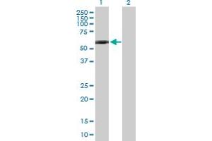 Western Blot analysis of GPI expression in transfected 293T cell line by GPI MaxPab polyclonal antibody. (GPI antibody  (AA 1-558))
