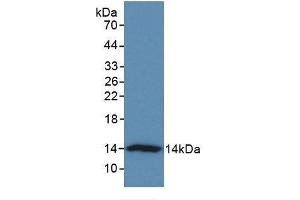 Detection of Recombinant VTCN1, Human using Monoclonal Antibody to V-Set Domain Containing T-Cell Activation Inhibitor 1 (VTCN1) (VTCN1 antibody  (AA 34-147))