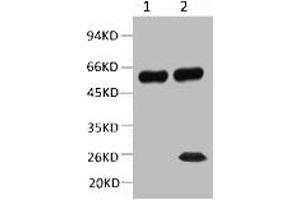 1) Input: Mouse Brain Tissue Lysate 2) IP product: IP dilute 1: 200 Western blot analysis: primary antibody : 1: 10000 Secondary antibody: Goat anti-Mouse IgG, Light chain specific (S003), 1: 5000