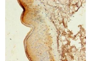 Immunohistochemistry of paraffin-embedded human skin tissue using ABIN7145104 at dilution of 1:100 (ATG16L1 antibody  (AA 1-607))