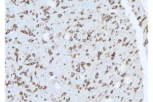 ABIN6272459 at 1/100 staining Mouse brain tissue by IHC-P. (ATP6V1H antibody  (Internal Region))