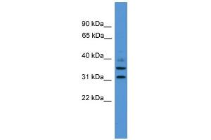 WB Suggested Anti-GIMAP6 Antibody Titration: 0. (GIMAP6 antibody  (C-Term))