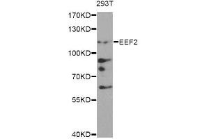 Western blot analysis of extracts of 293T cells, using EEF2 antibody. (EEF2 antibody)