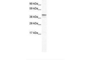 Image no. 1 for anti-Zinc Finger Protein 627 (ZNF627) (AA 44-93) antibody (ABIN6735960) (ZNF627 antibody  (AA 44-93))