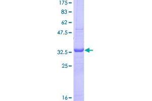 Image no. 1 for Cytotoxic T-Lymphocyte-Associated Protein 4 (CTLA4) (AA 36-135) protein (GST tag) (ABIN1350656)
