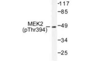 Image no. 1 for anti-Mitogen-Activated Protein Kinase Kinase 2 (MAP2K2) (pThr394) antibody (ABIN318069) (MEK2 antibody  (pThr394))