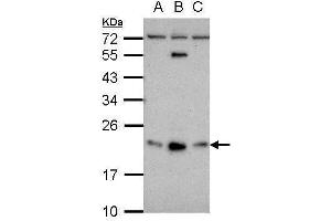 WB Image Sample (30 ug of whole cell lysate) A: NT2D1 B: PC-3 C: U87-MG 12% SDS PAGE antibody diluted at 1:500 (GLIPR1L1 antibody  (Center))