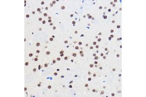 Immunohistochemistry of paraffin-embedded Mouse brain using GTF3C3 Rabbit pAb (ABIN7267374) at dilution of 1:100 (40x lens). (GTF3C3 antibody)