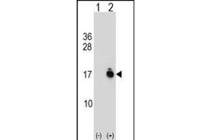 Western blot analysis of ACYP1 (arrow) using rabbit polyclonal ACYP1 Antibody (C-term) (ABIN1537423 and ABIN2849002). (ACYP1 antibody  (C-Term))