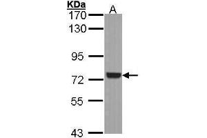 WB Image Sample (30 ug of whole cell lysate) A: A431 , 7. (SYK antibody  (Internal Region))