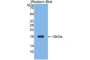 Detection of Recombinant FN, Mouse using Polyclonal Antibody to Fibronectin (FN) (Fibronectin antibody  (AA 2117-2236))