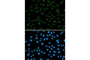 Immunofluorescence analysis of A549 cell using AR antibody. (Androgen Receptor antibody)