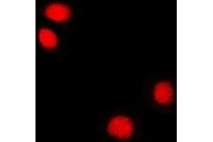 Immunofluorescent analysis of Reptin 52 staining in U2OS cells. (RUVBL2 antibody)