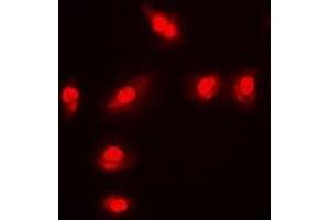 Immunofluorescent analysis of FOXO1 (pS256) staining in MCF7 cells.