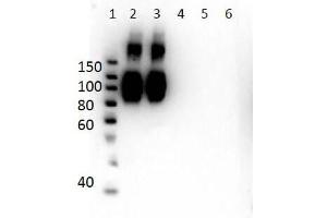 Western Blot of Mouse Anti-Hemoglobin A (beta chain) Antibody. (Hemoglobin Subunit beta antibody  (N-Term))