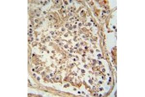 Immunohistochemistry analysis in formalin fixed and paraffin embedded human testis tissue reacted with GTPBP2 antibody (C-term) followed by peroxidase conjugation of the secondary antibody and DAB staining.